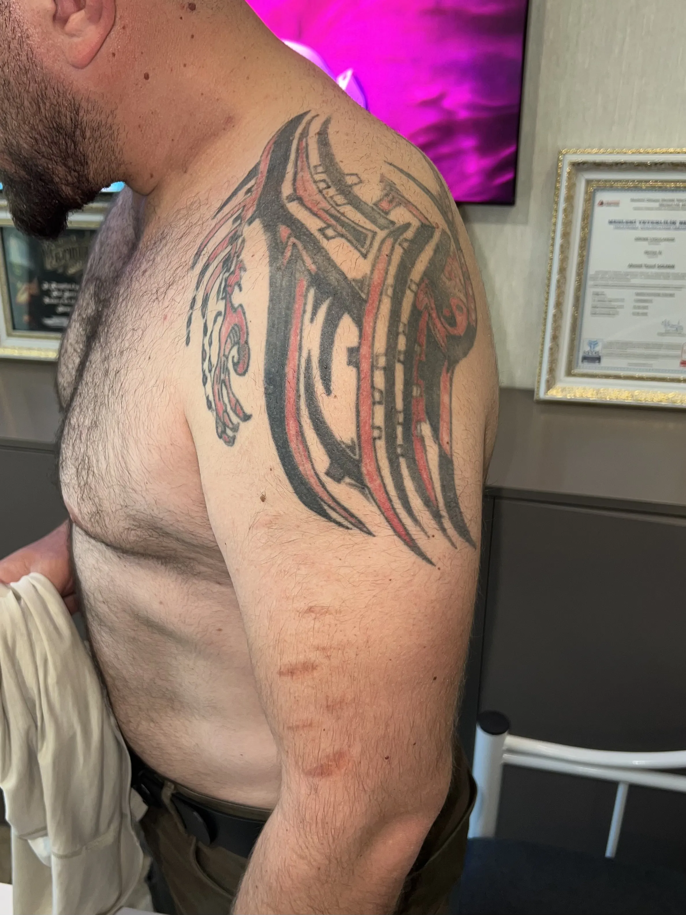Cover-Up Dövme Öncesi - Konya NO2 Tattoos Station Eski Dövme Örneği
